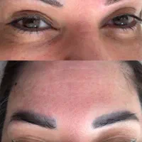 ریمووتخصصی ابروخط چشم تک جلسه ای با مواد رجووی