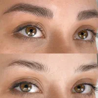 مرکزفیبروزابرو در بلوارستاره(تخفیف)