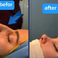 جراح زیبایی جراحی بینی، لیفت صورت