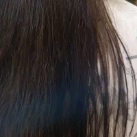 تخفیف موخوره۳۰۰