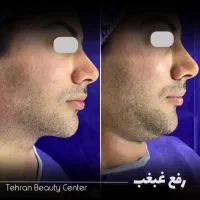 کلینیک فوق تخصصی/کاشت مو / ابرو|خدمات آرایشگری و زیبایی|زاهدان, |دیوار