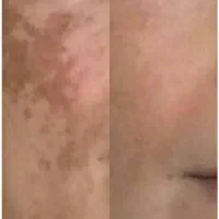 پوست شاداب با طب سنتی