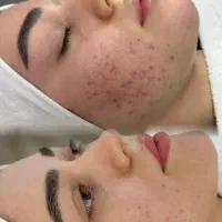 فشیال تخصصی ودرمانی