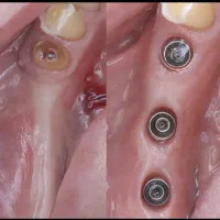 دندانپزشکی ایمپلنت و..بااقساط بلندمدت در تبریز|خدمات آرایشگری و زیبایی|مرند, |دیوار