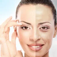 رفع لک جوش و ریزش مو مشاوره رایگان توسط کارشناس