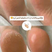 برای تکمیل پیچ نیاز ب مدل دارم برای پدیکور وکراتین
