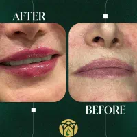 جشنواره خدمات پزشکی و جراحی و زیبایی در محدوده حرم|خدمات آرایشگری و زیبایی|مشهد, بالا خیابان|دیوار