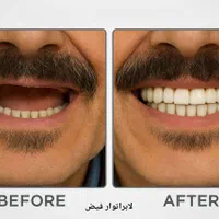 دندان‌سازی. دندان‌مصنوعی. لابراتوار دندانسازی|خدمات آرایشگری و زیبایی|مشهد, ولیعصر (شهرک غرب)|دیوار