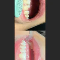 جشنواره دندانپزشکی زیبایی و درمانی|خدمات آرایشگری و زیبایی|تبریز, |دیوار