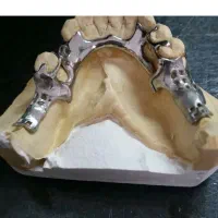 وسایل دندانپزشکی گم شده