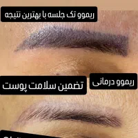 ریموو و پاک کردن تضمینی تتوی ابرو و چشم شما|خدمات آرایشگری و زیبایی|ایلام, |دیوار