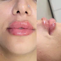 تخفیف تکرارنشدنی ۱۹ شهریور|خدمات آرایشگری و زیبایی|رشت, چله خانه|دیوار