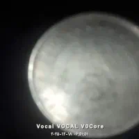 15عددسکه توافقی بفروش میرسد|کلکسیون سکه، تمبر، اسکناس|دامغان, |دیوار