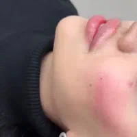 آموزش‌ژل‌وبوتاکس‌همراه‌مدرک