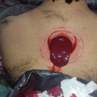 حجامت|خدمات آرایشگری و زیبایی|زاهدان, |دیوار