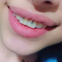 پیرسینگ بدن