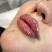 مدل فیشیالcip با دستگاه آنالیز دار و هوش مصنوعی|خدمات آرایشگری و زیبایی|کرج, گلشهر|دیوار