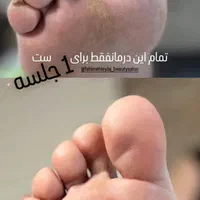 جهت تکمیل آلبوم|خدمات آرایشگری و زیبایی|رشت, گلباغ نماز|دیوار