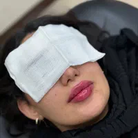 تزریق ژل و بوتاکس اف تا فردافقط۷۰۰