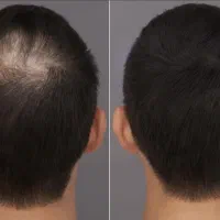 فیبروز ابرو شیدینگ لب و اسکالپ سر بانوان و اقایان|خدمات آرایشگری و زیبایی|صدرا-فارس, فاز ۱|دیوار