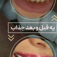 جشنواره کامپوزیت از ۵۹۰|خدمات آرایشگری و زیبایی|اهواز, کیانپارس |دیوار