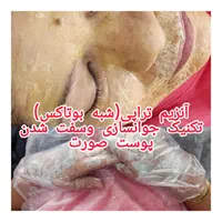 فیشال تخصصی/پلاژن تراپی/کربوکسی /پارافین تراپی|خدمات آرایشگری و زیبایی|کرمان, |دیوار