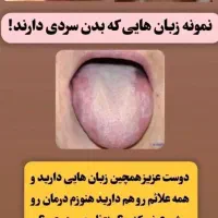 سردی و بلغم