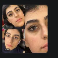 نیازمند مدل کاشت مژه با کمترین هزینه(فوری)