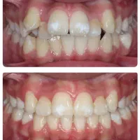 ارتودنسی اقساط بلندمدت