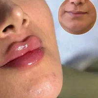 خدمات ژل و بوتاکس آمپول و سرم به صورت سیار