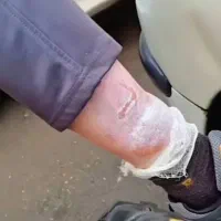 محافظ رادیات بخاری ۲۰۶ /۲۰۷/رانا/رانا پلاس|قطعات یدکی و لوازم جانبی|فومن, |دیوار