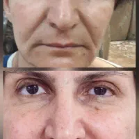 تخفیف 10 تا 20 درصدکلیه خدمات زیبایی در شمس ابادی|خدمات آرایشگری و زیبایی|اصفهان, خلجا|دیوار