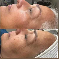 آموزش های / حرفه ای پوست/ با مدرک