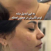 هایفو ۱۲ بعدی ۲۰۲۶ باجوابدهی عالی با هوش مصنوعی