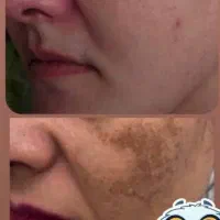 کرم وی ای پی اصل صدرصد تضمینی و بدون بازگشت|آرایشی، بهداشتی، درمانی|یاسوج, |دیوار