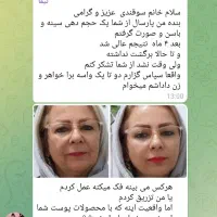 کاهش اشتها،چربی سوزی،لاغری،پاکسازی کبد