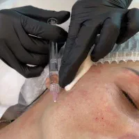 مرکز مجهز تزریق فیلر انواع ژل بوتاکس و لیزرمحمدشهر