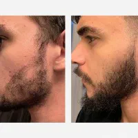 این تار اخریشه