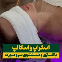 خدمات آرامش مدهوش تضمینی|خدمات آرایشگری و زیبایی|یزد, |دیوار