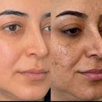 ضدلک یکی بخر دوتا ببر رایگان بیوممتیک٪50تخفیف ویژه