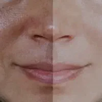 مزووایت تیرگی‌های بدن روشن‌کننده تخصصی پوست