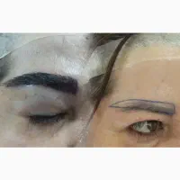 کاشت ابرو مزوتراپی نصف قیمت