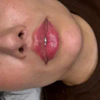 جشنواره تابستانه مطب پزشک زیبایی|خدمات آرایشگری و زیبایی|شیراز, ابیوردی|دیوار
