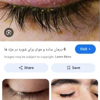 راهنمایی آشغال مژه و پلک