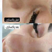 مدل فیشیال ویژه با یکبار فیشیال تغییر رااحساس کنید|خدمات آرایشگری و زیبایی|کرج, گلشهر|دیوار