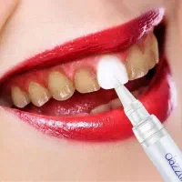 قلم سفید کننده دندان /لمینت/زیبایی/کامپوزیت