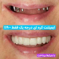 ایمپلنت دندان کره ای درجه ۱