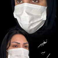 کاشت ابرو کاملا طبیعی و با بهترین تکنیک
