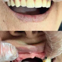 دندانپزشکی با پرداخت یک سوم هزینه|خدمات آرایشگری و زیبایی|سقز, |دیوار