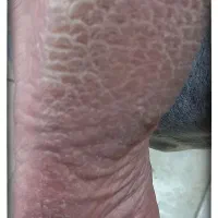 رفع ترک و تیرگی پا کفسابی پدیکور ۳۵۰ در یک جلسه|خدمات آرایشگری و زیبایی|بروجرد, |دیوار